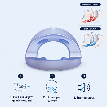 Avero Flow - Anti-Snoring Device
